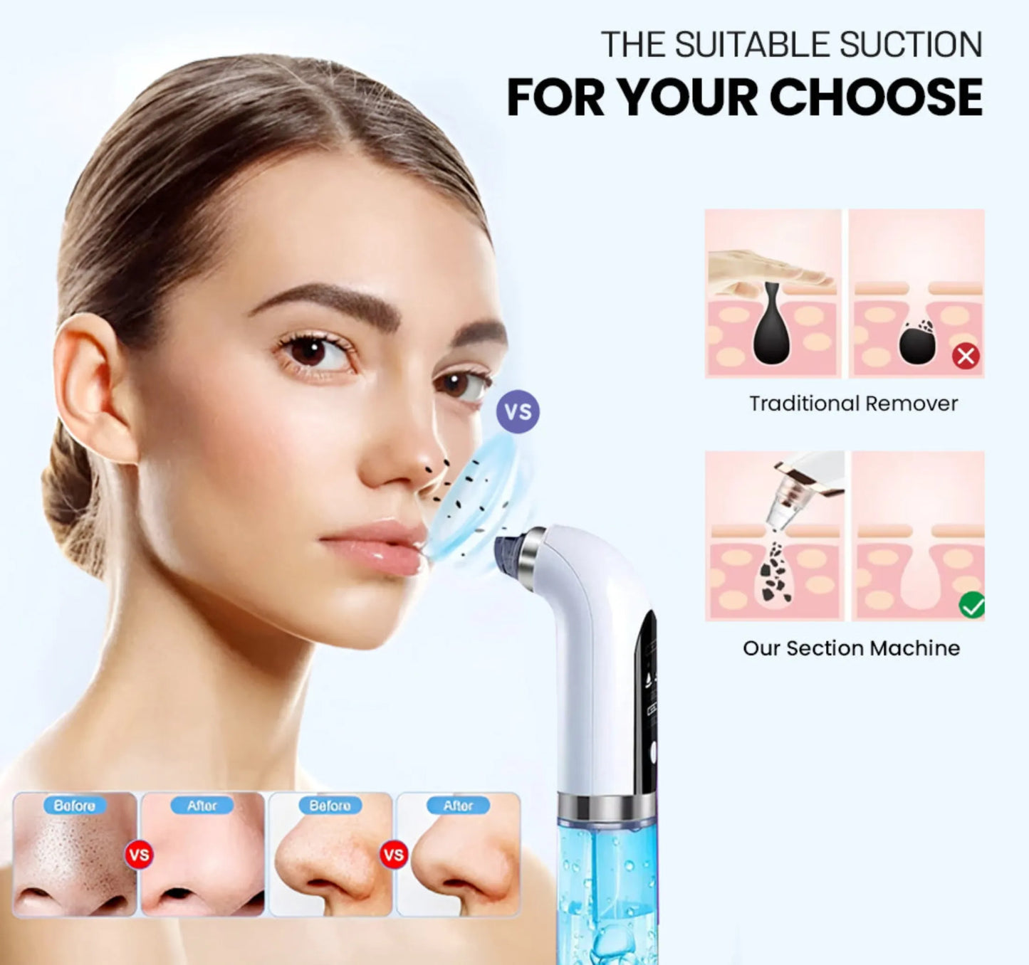 Bubble Facial & Blackhead Remover – Deep Cleanser for Acne, Pores & Glowing Skin | Pimple & Oil Control tool | Blemish-Fighting & Matte Finish | Bubble Technology Pore Purifier