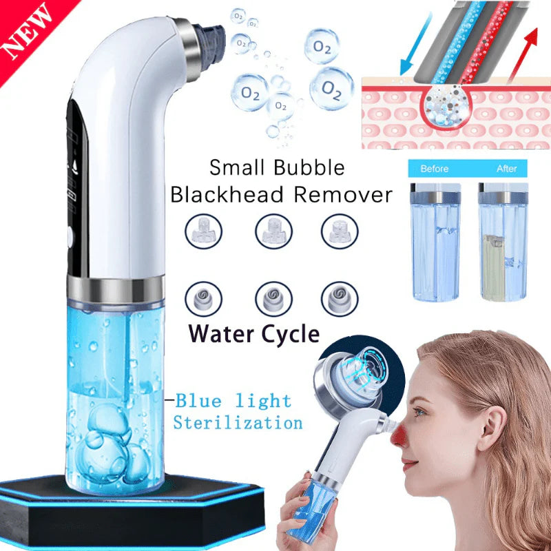 Bubble Facial &amp; Blackhead Remover – Deep Cleanser for Acne, Pores &amp; Glowing Skin | Pimple &amp; Oil Control tool | Blemish-Fighting &amp; Matte Finish | Bubble Technology Pore Purifier 